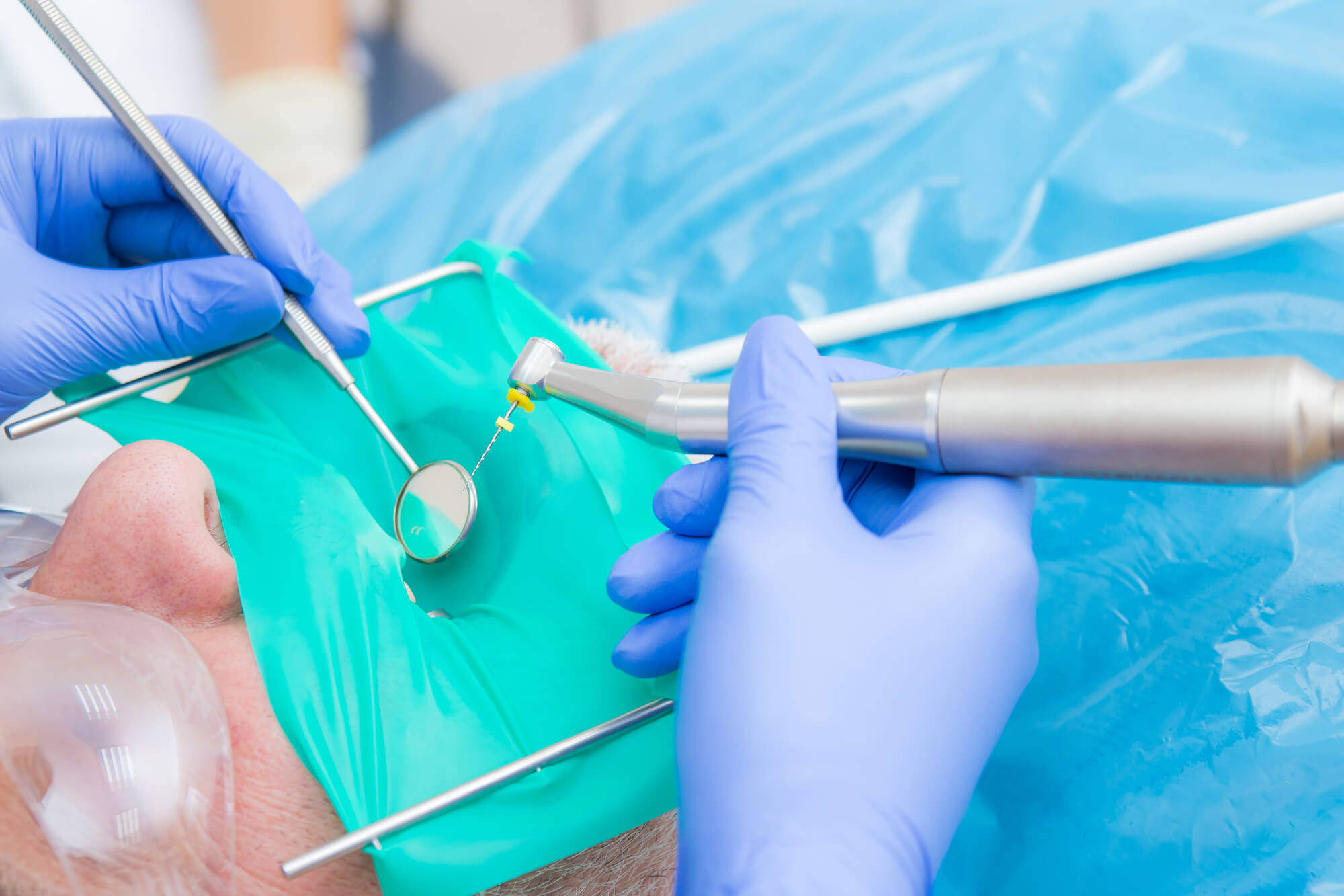 Mechanicsville Sedation Endodontist Performs Dental Treatment