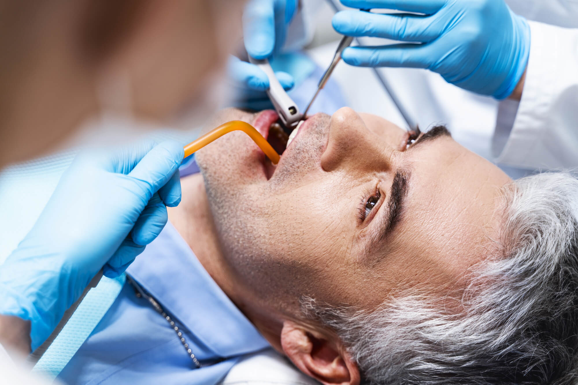 older man receiving richmond root canal therapy