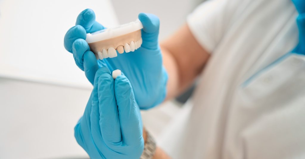 A person wearing blue gloves holding a tooth model with a missing gap in one hand, and a model tooth crown in the other.