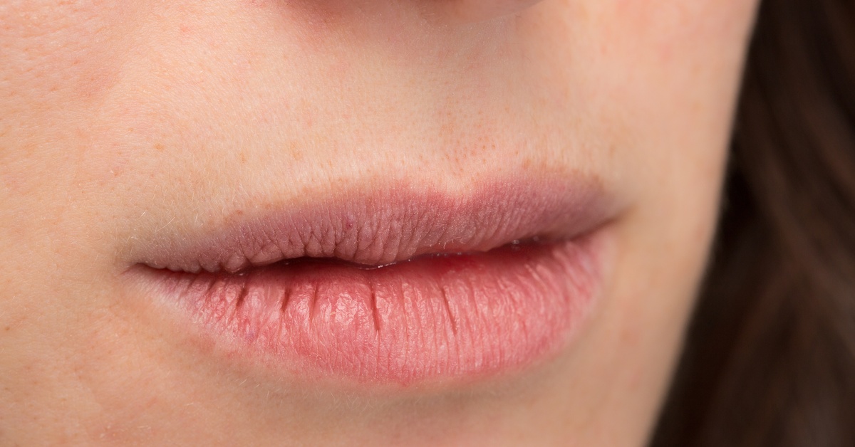 A macro close-up of a woman’s lips showing dry, cracked skin texture with visible lines and peeling areas.