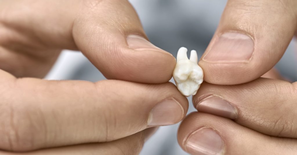 A close up of a white molar tooth held between a person’s fingers against a plain background with focus on the tooth.