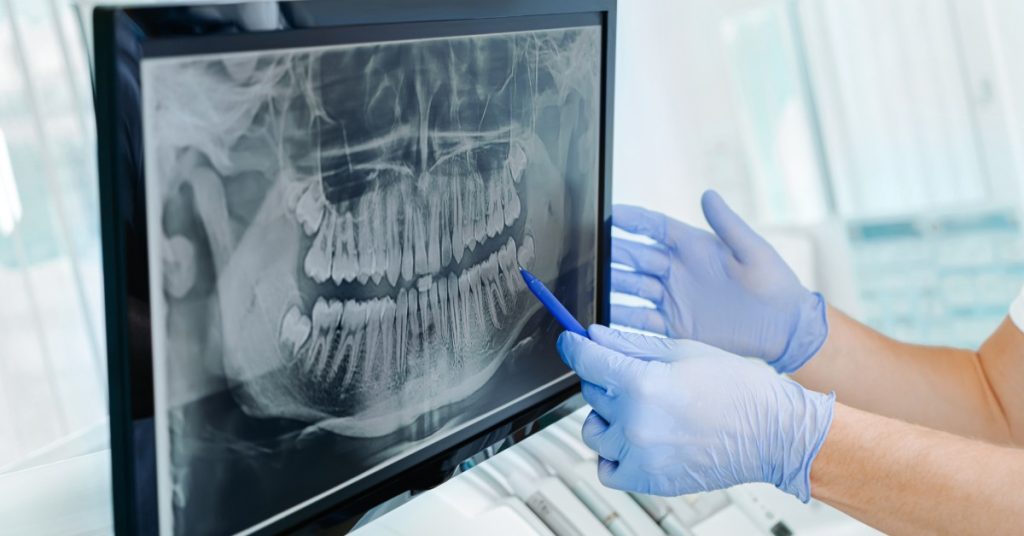 A dental professional in gloves holds up a dental x-ray image on a screen with teeth visible and equipment in the background.
