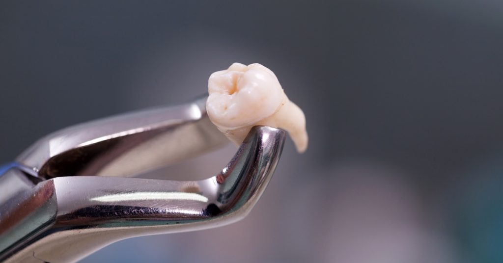 A close-up of metal forceps gripping a tooth, shown against a softly blurred gray and blue background.