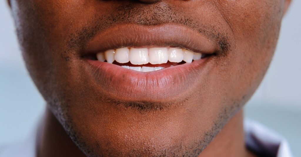 A close-up of a person's mouth with teeth showing, lips parted, and light facial hair visible around the mouth.