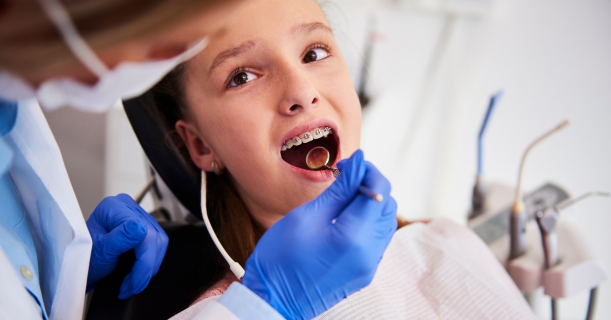 A child with braces reclining in a dental chair while gloved hands hold a mouth mirror near the child's teeth.