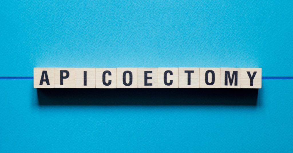 Wooden letter cubes spelling apicoectomy arranged in a straight row on a bright blue surface with empty space.