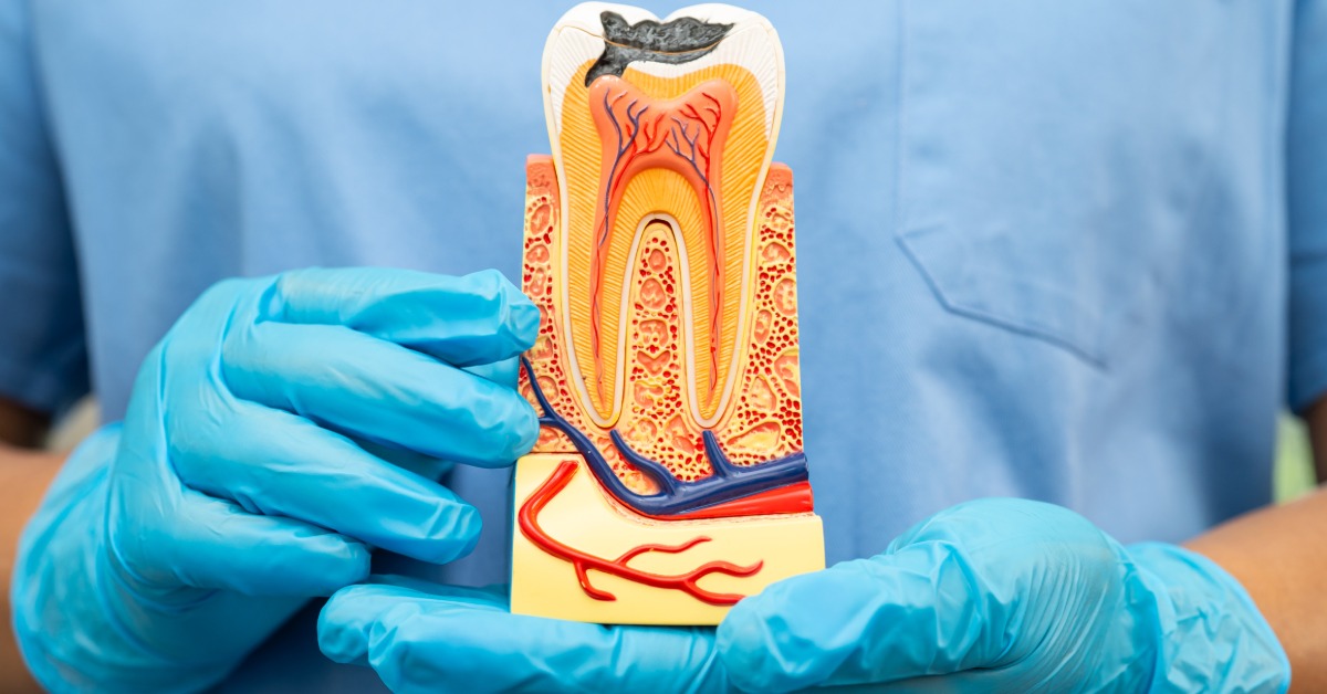 A person wearing blue gloves holding a tooth anatomy model with visible roots, nerves, and gum structures.